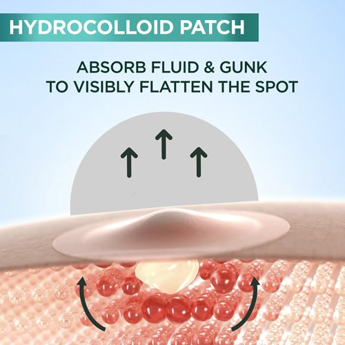 garnier ecom pimplepatch July2024 technology